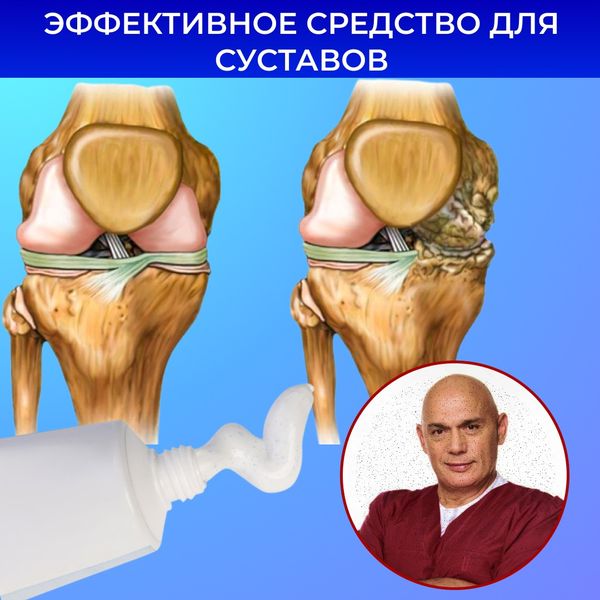 Креативы для суставов, cpa арбитраж трафика