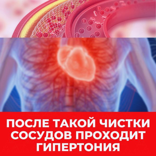 Креативы для гипертонии, cpa арбитраж трафика
