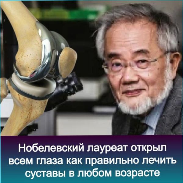 Креативы для суставов, cpa арбитраж трафика