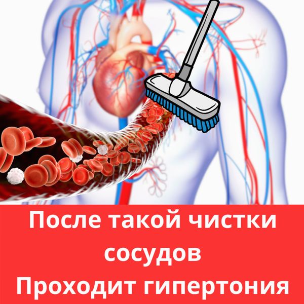 Креативы для гипертонии, cpa арбитраж трафика