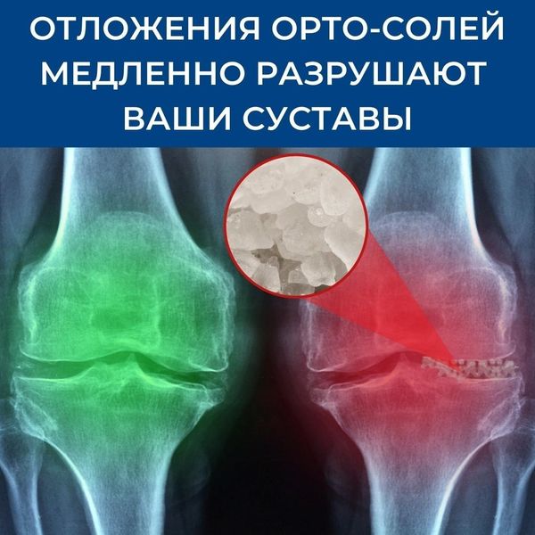 Креативы для суставов, cpa арбитраж трафика